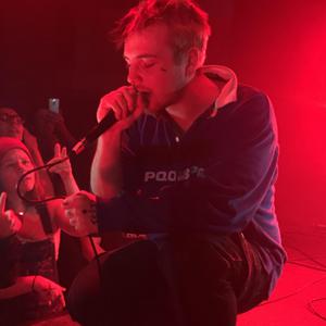 鲤鱼乡孕夫前列腺
